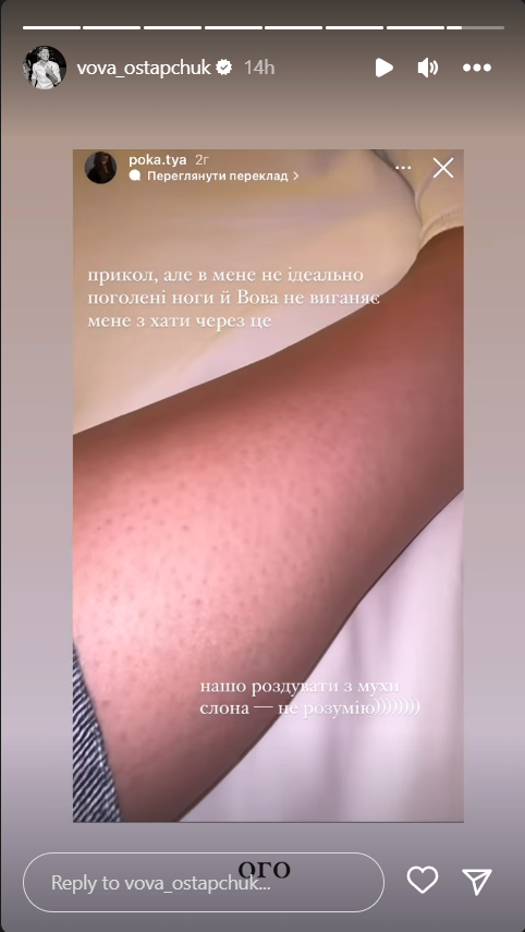 "Мне вообще не ок". Владимир Остапчук нарвался на критику из-за депиляции ног у женщин: чем закончился скандал